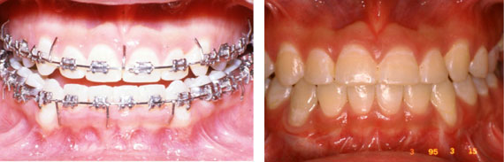 Oral and Maxillofacial Surgery