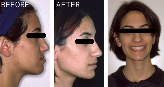 Maxillofacial Surgery