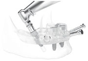 NobelGuide Dental Technology
